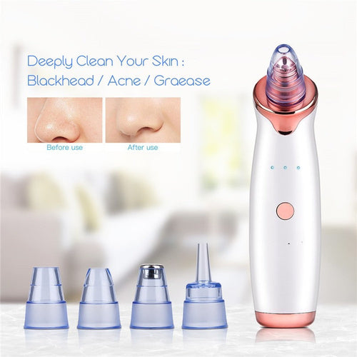 Vacuum Blackhead Remover Pimple Acne Removal Tool Skin Care Pore