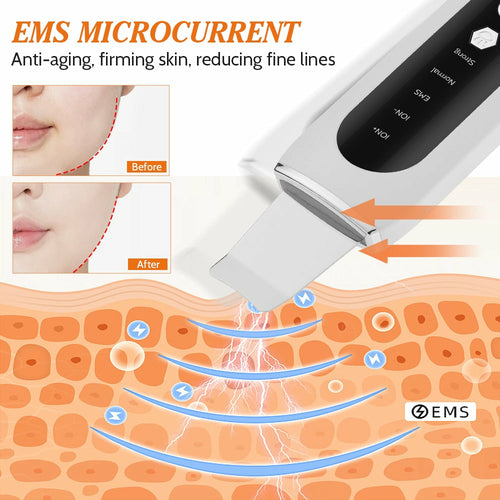 Ultrasonic Skin Scrubber EMS Microcurrent Face Lifting