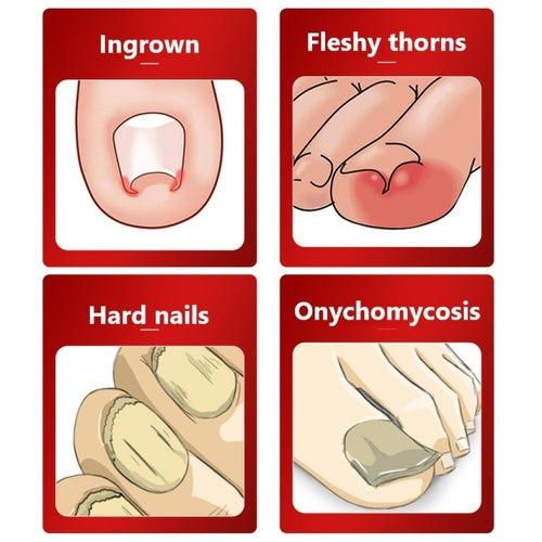 Dead Skin Dirt Remover Pedicure Care Tool Pro